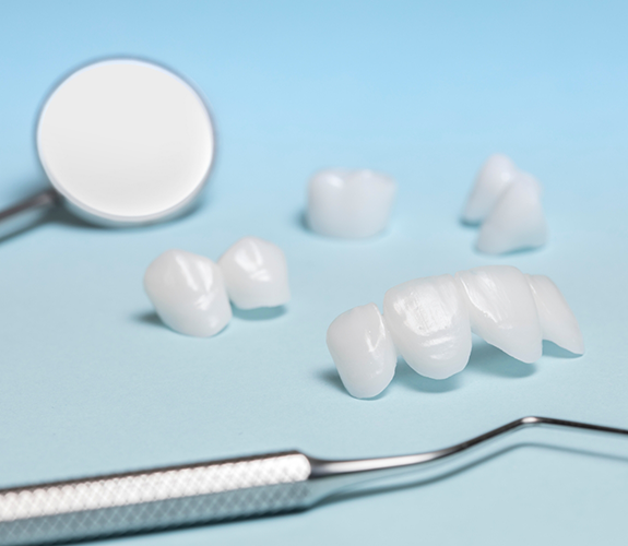 Several veneers against a pale blue background with a dental mirror